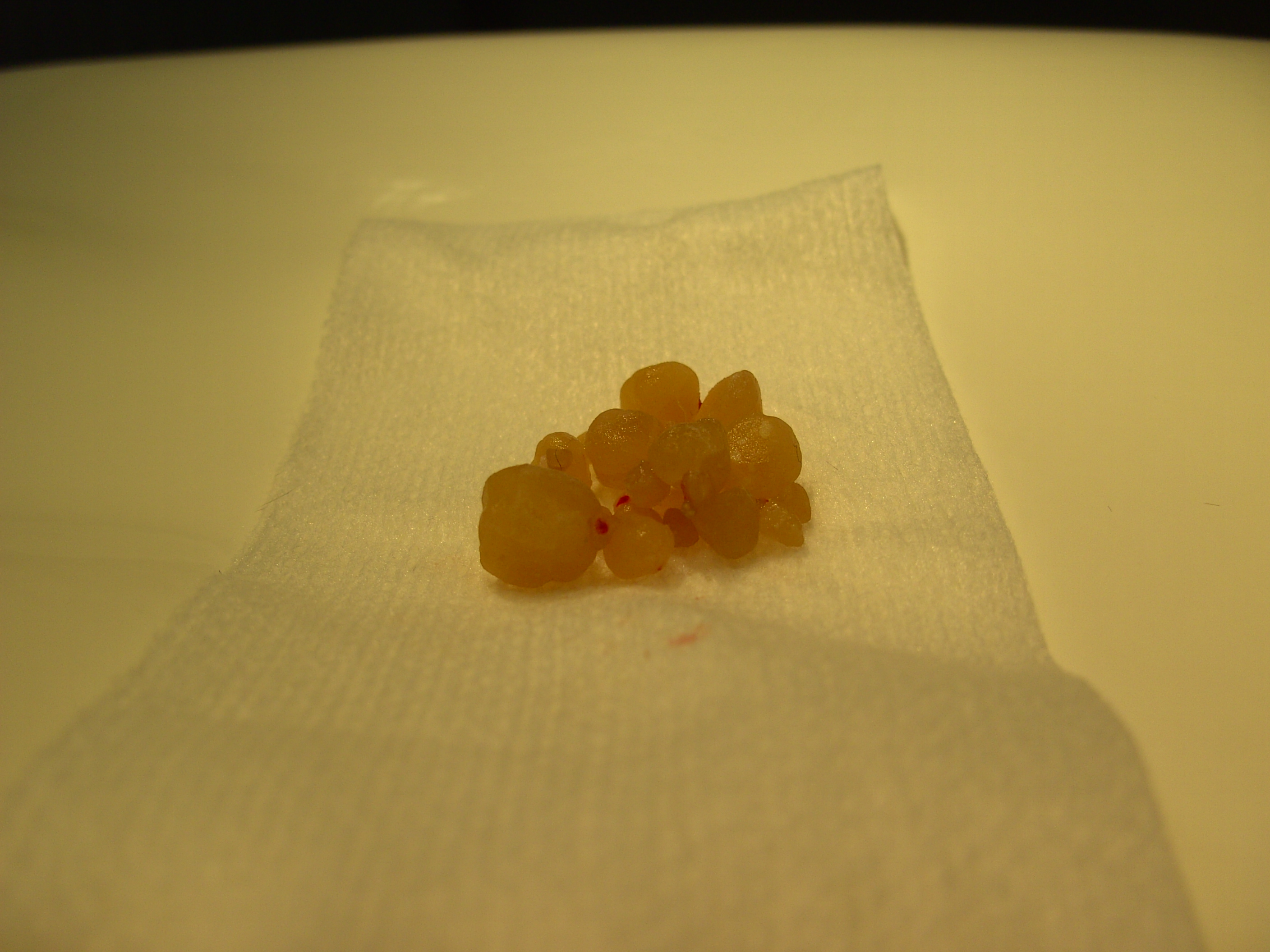 blaasstenen daisy 10